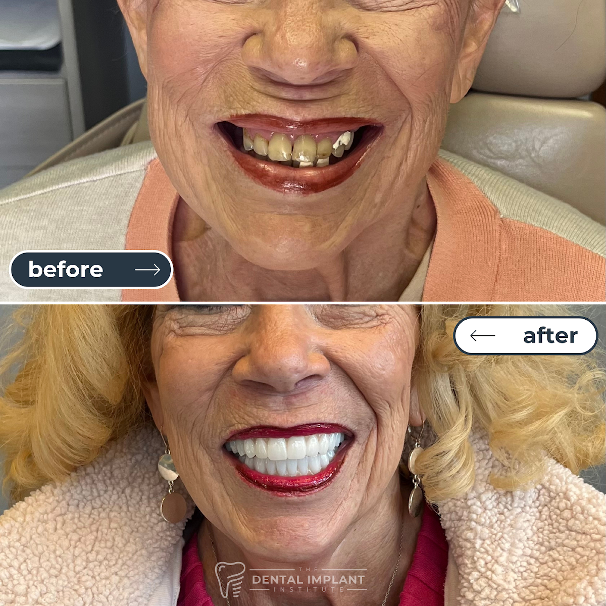 Dental Implant Institute photo 6