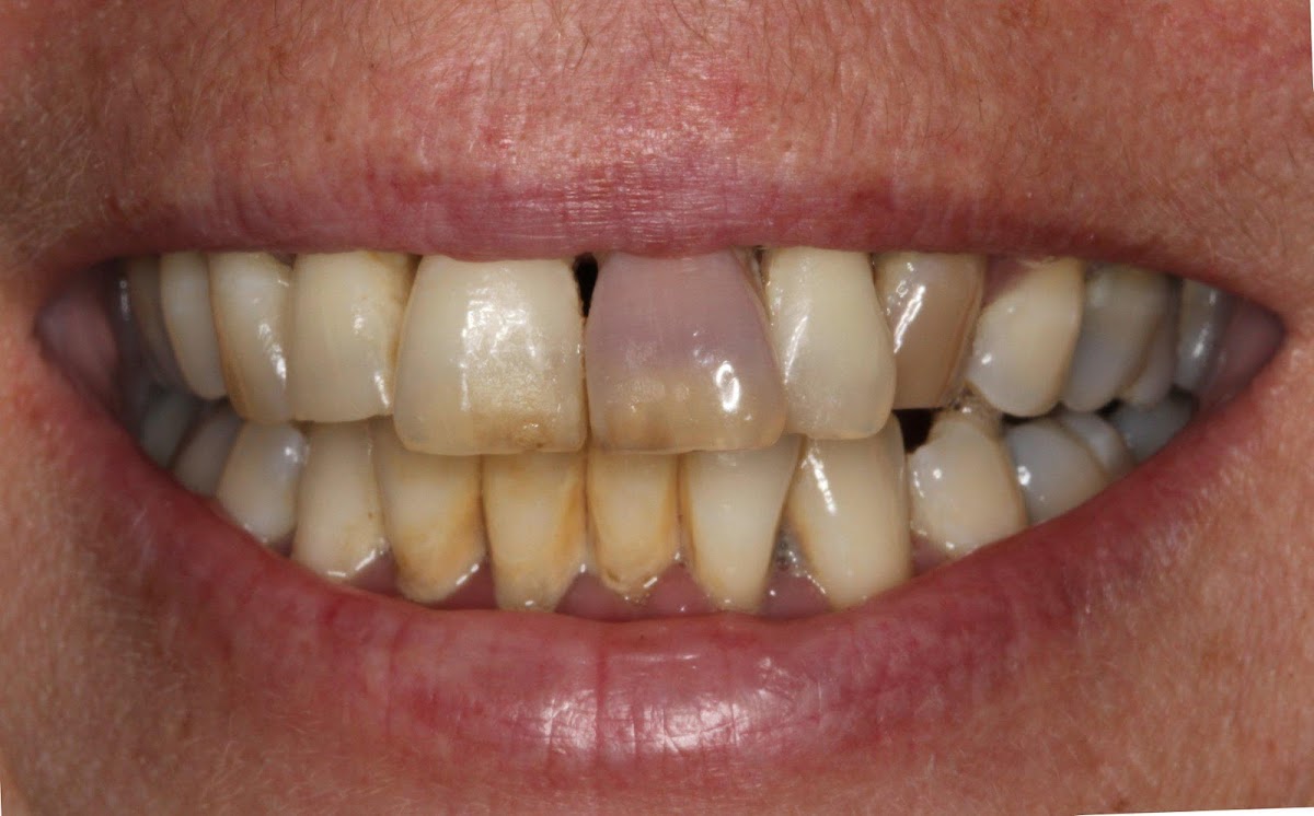 Florida Dental Implant & Aesthetic Center photo 1
