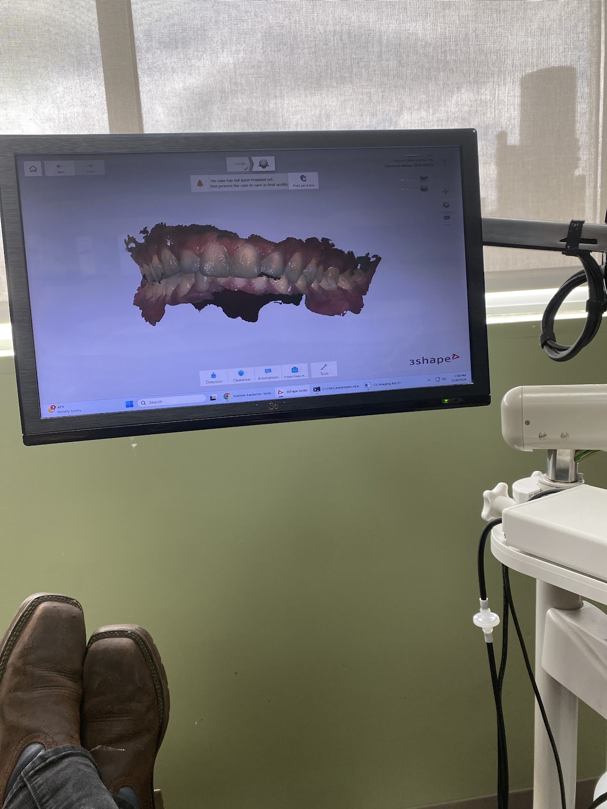 Aspen Dental - Merrillville photo 3