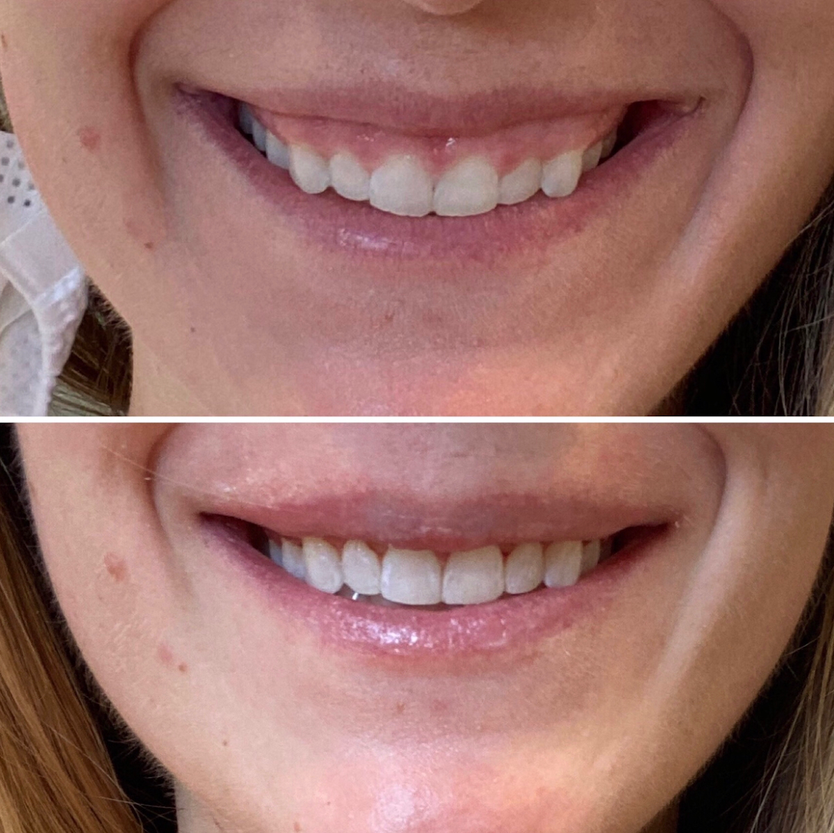 Cherry Hill Dental photo 6