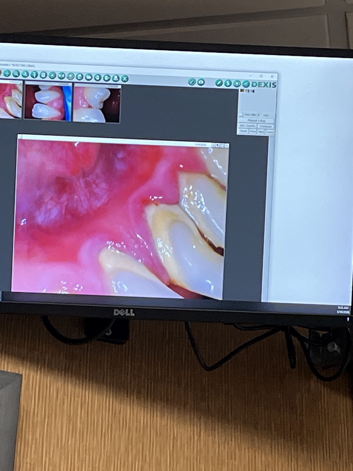 Merkley Dental photo 3