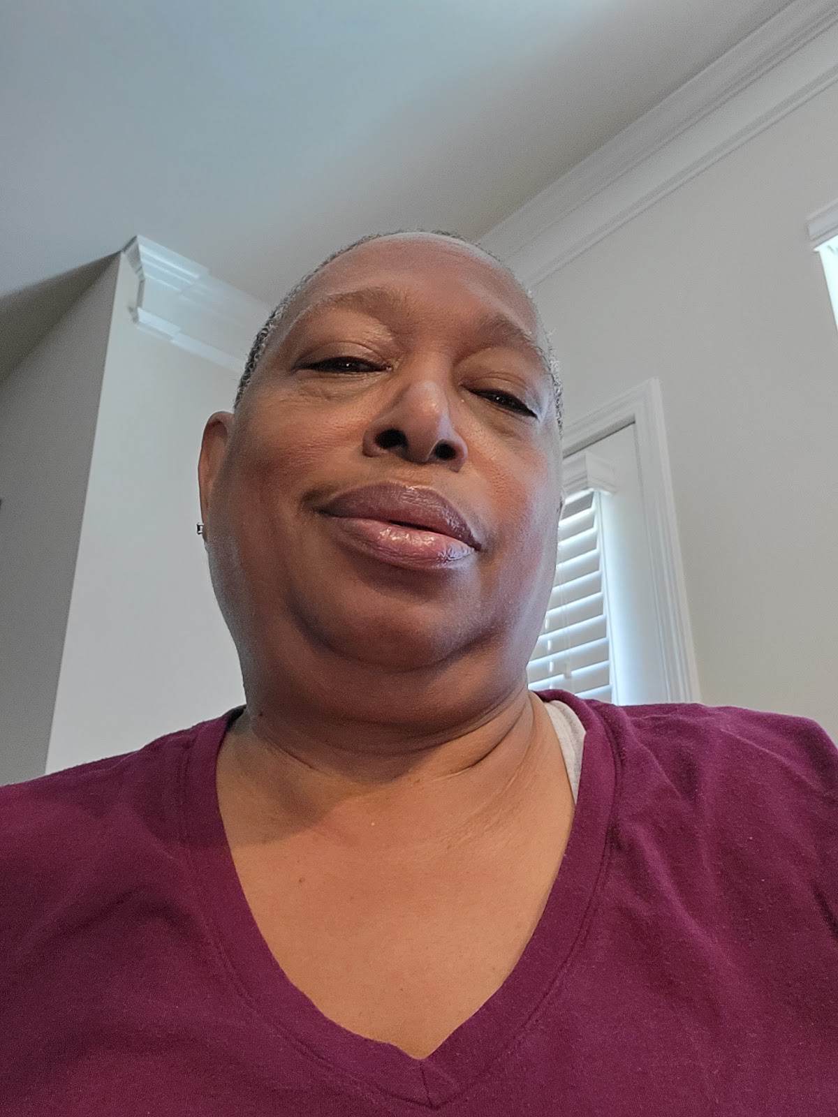 Aspen Dental - Covington photo 6