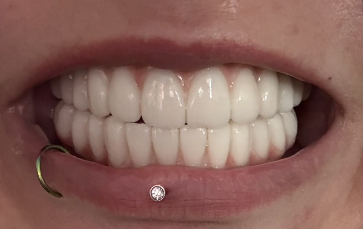 Affordable Dentures & Implants - Boise photo 5