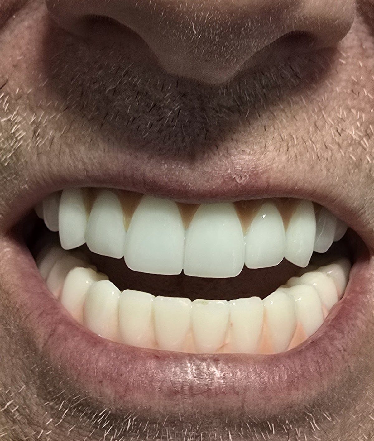 Affordable Dentures & Implants - Boise photo 6