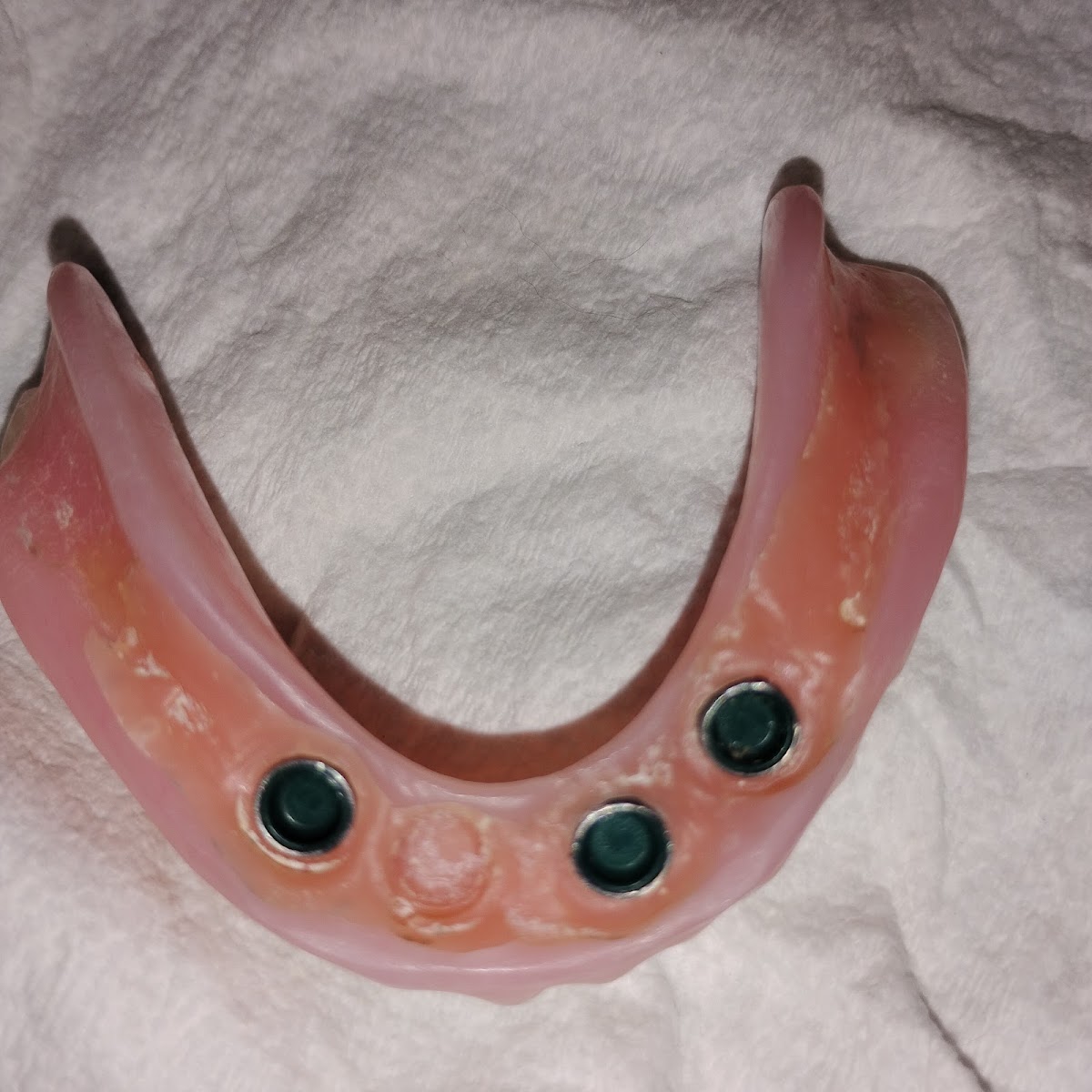 Affordable Dentures & Implants - Ocala photo 6