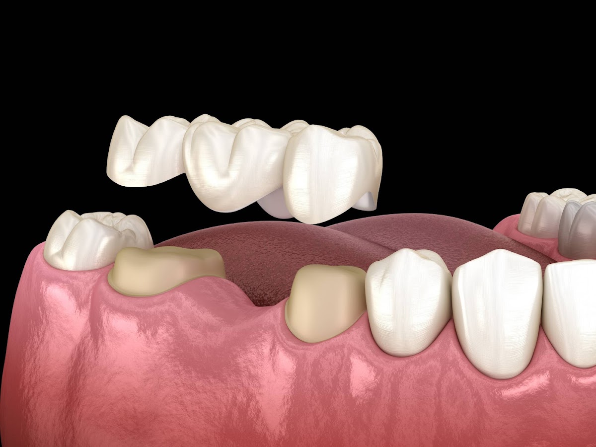 Solana Smiles & Implant Center photo 2