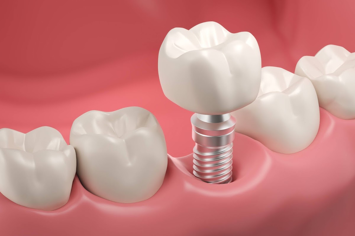 Solana Smiles & Implant Center photo 3