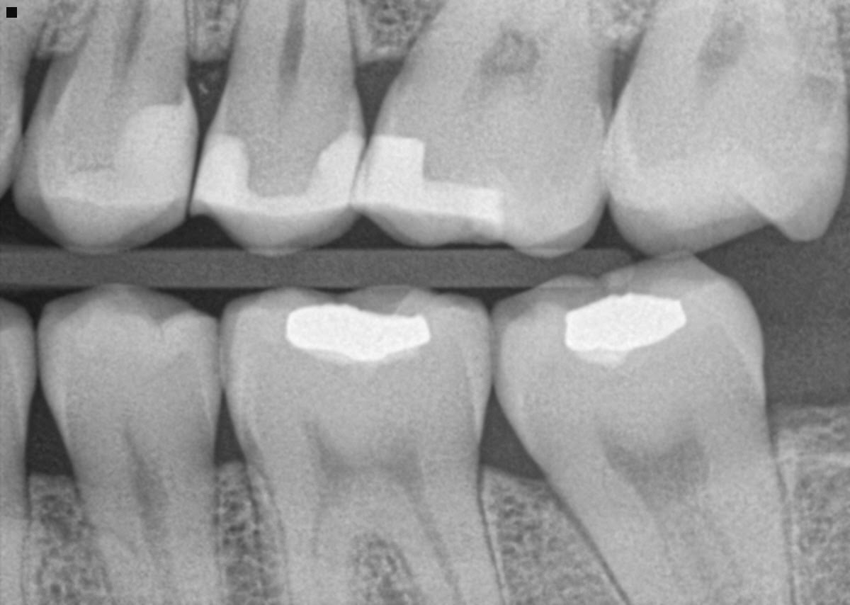 My Smiles Dental Center photo 3