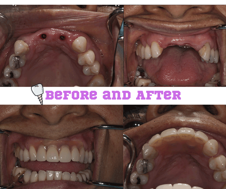 One Stop Implants photo 5