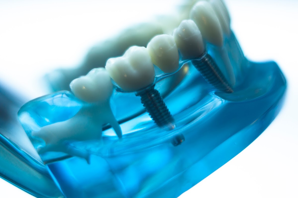 Sun Dental photo 4