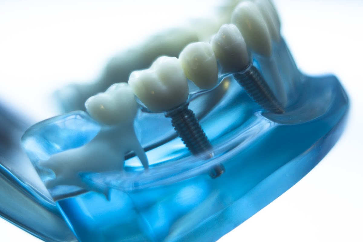 Sun Dental photo 4