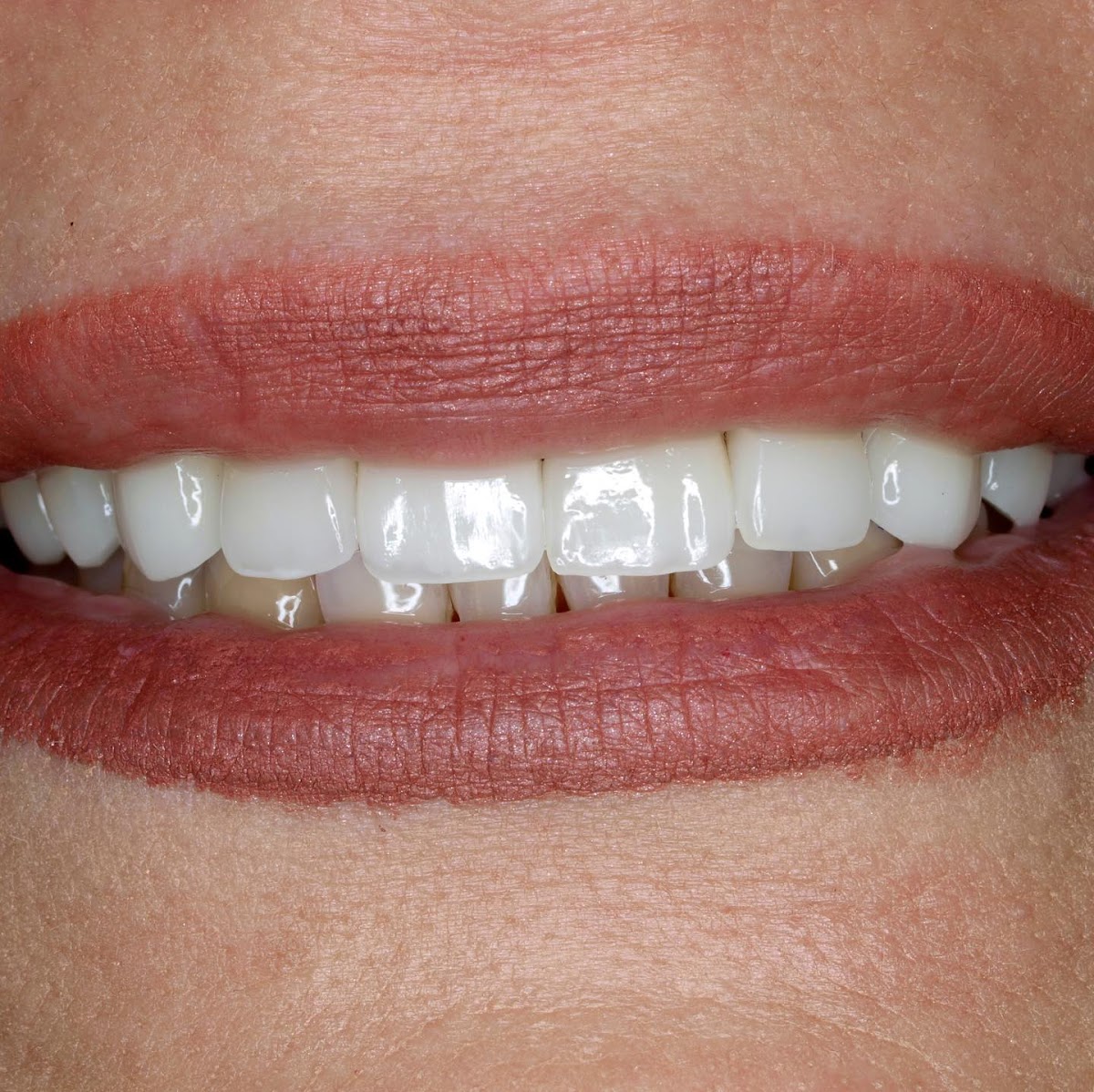 Laredo Dental Care photo 4