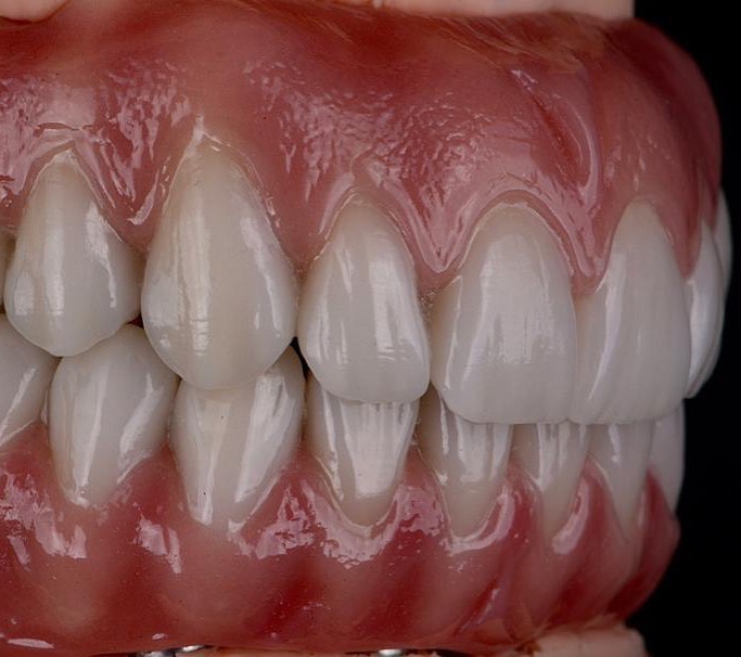 Regional Implant Centers photo 6