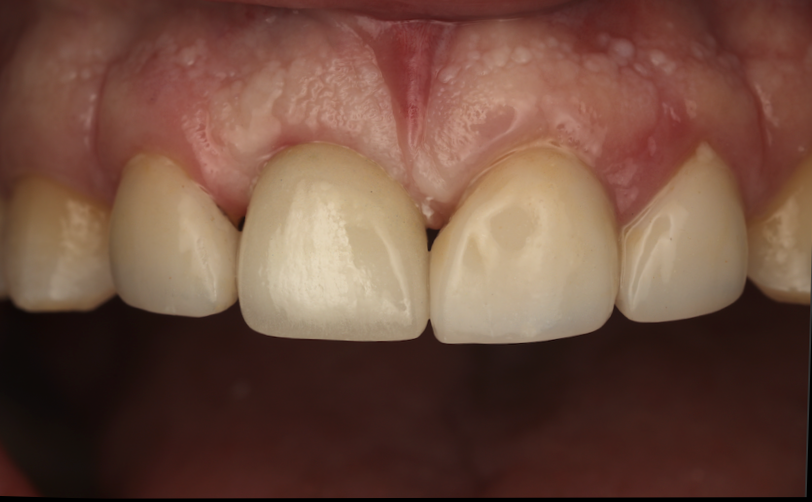 Ben Choi Periodontics & Implants photo 3