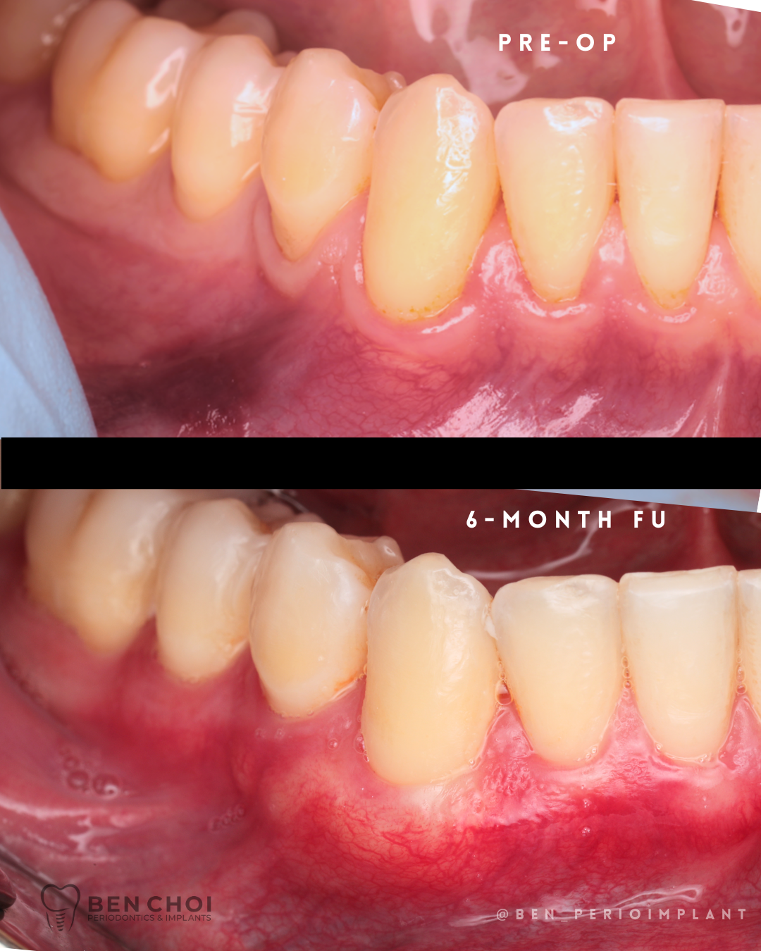Ben Choi Periodontics & Implants photo 5