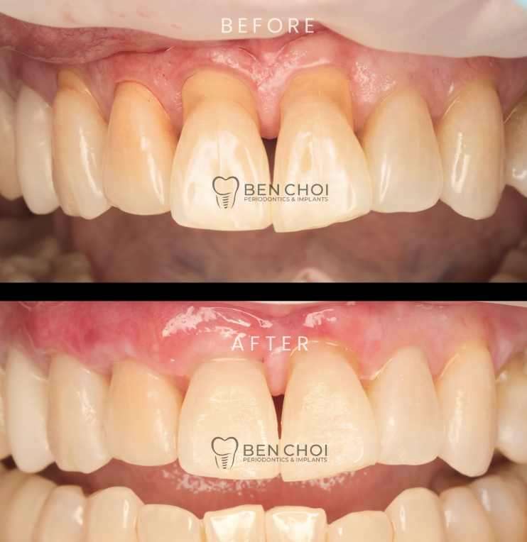 Ben Choi Periodontics & Implants photo 6