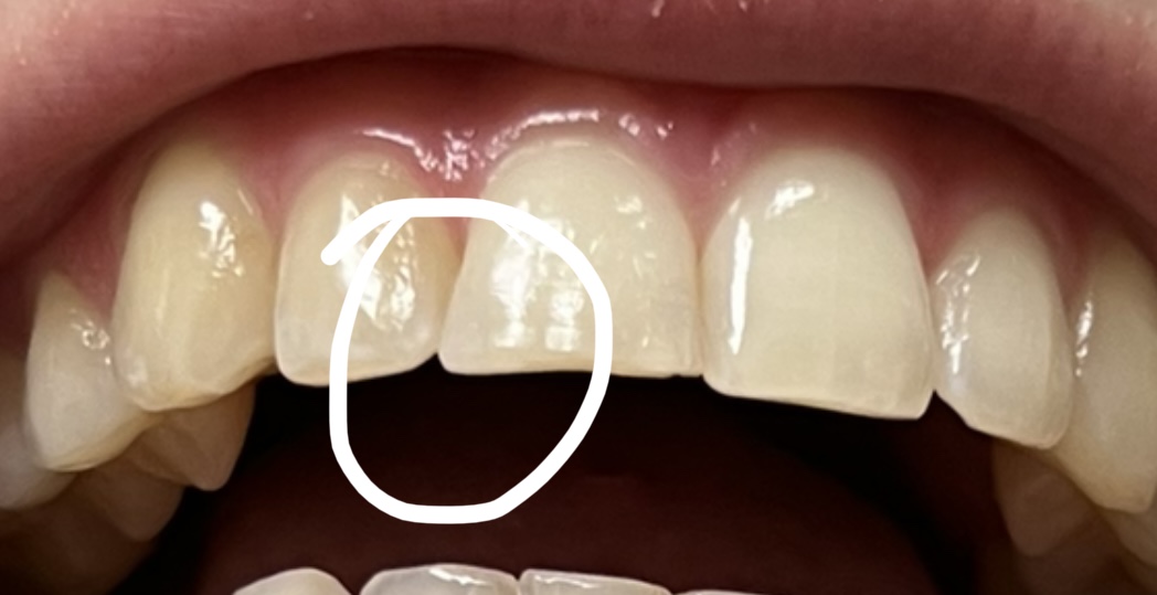 Advanced Premier Dental And Implant Dentistry photo 3