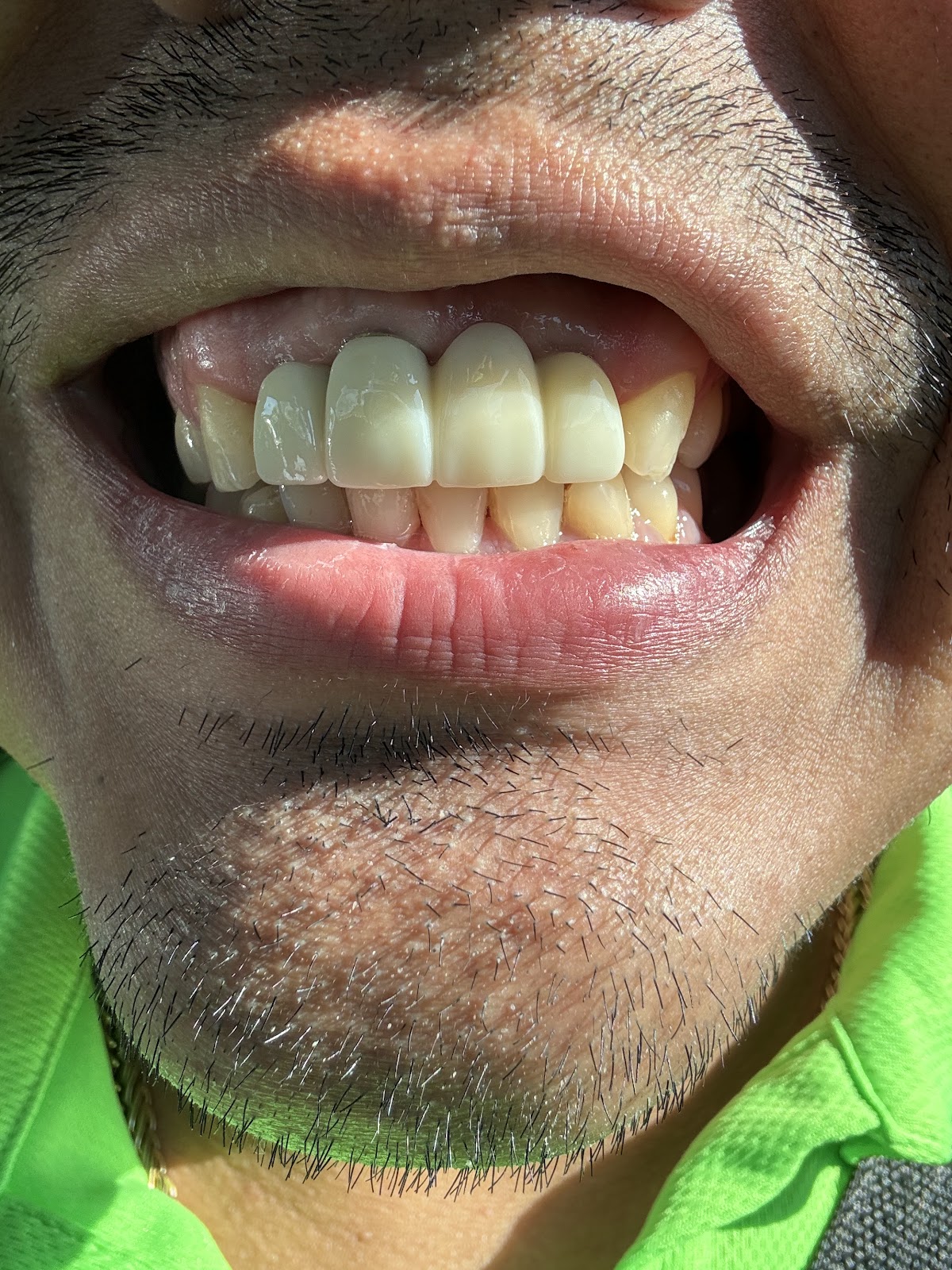 Aspen Dental - Dundalk photo 4