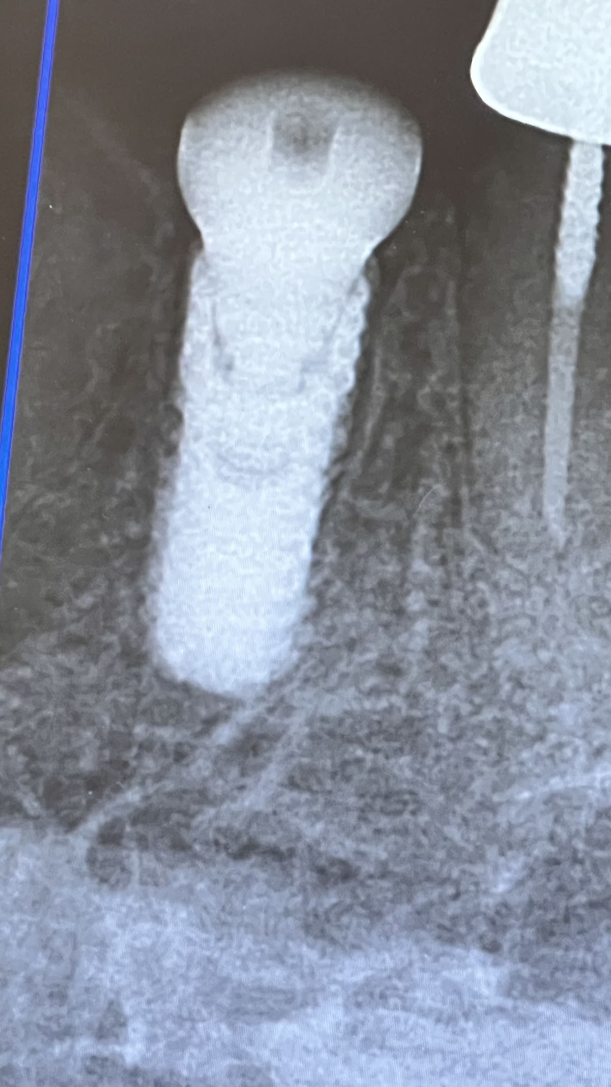 Fort Mohave Dental photo 4