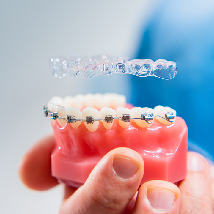 East Bay Dental - Dental Implants, Orthodontist Dentist photo 1