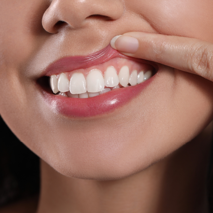 East Bay Dental - Dental Implants, Orthodontist Dentist photo 4