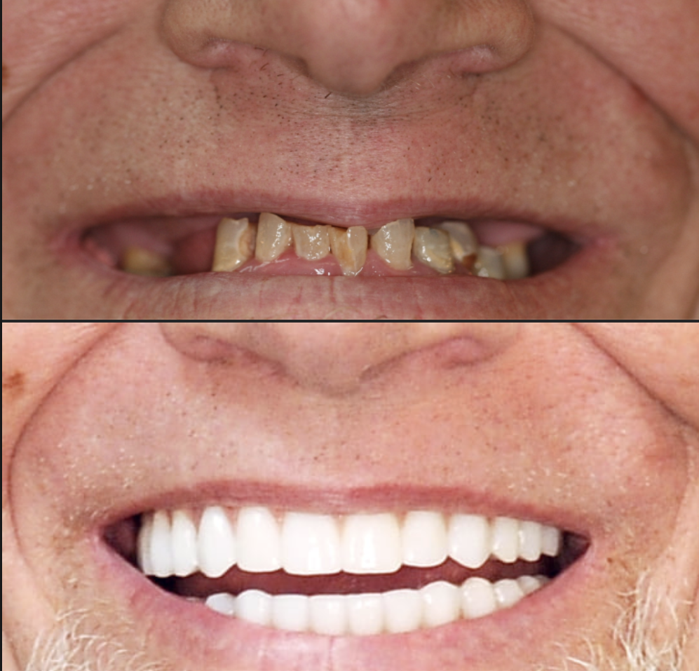 4m Dental Implant Center photo 2