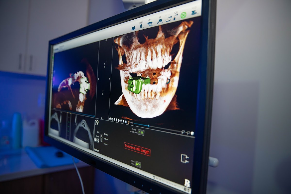 Regen Periodontics & Dental Implant Center photo 5