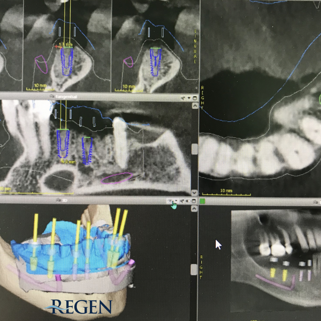 Regen Periodontics & Dental Implant Center photo 6