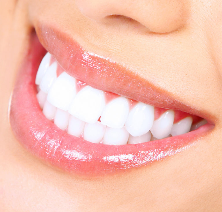 Des Moines Family Dentistry photo 1