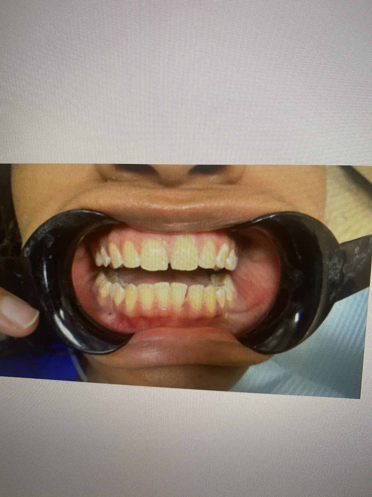 Aspen Dental - Houston photo 5