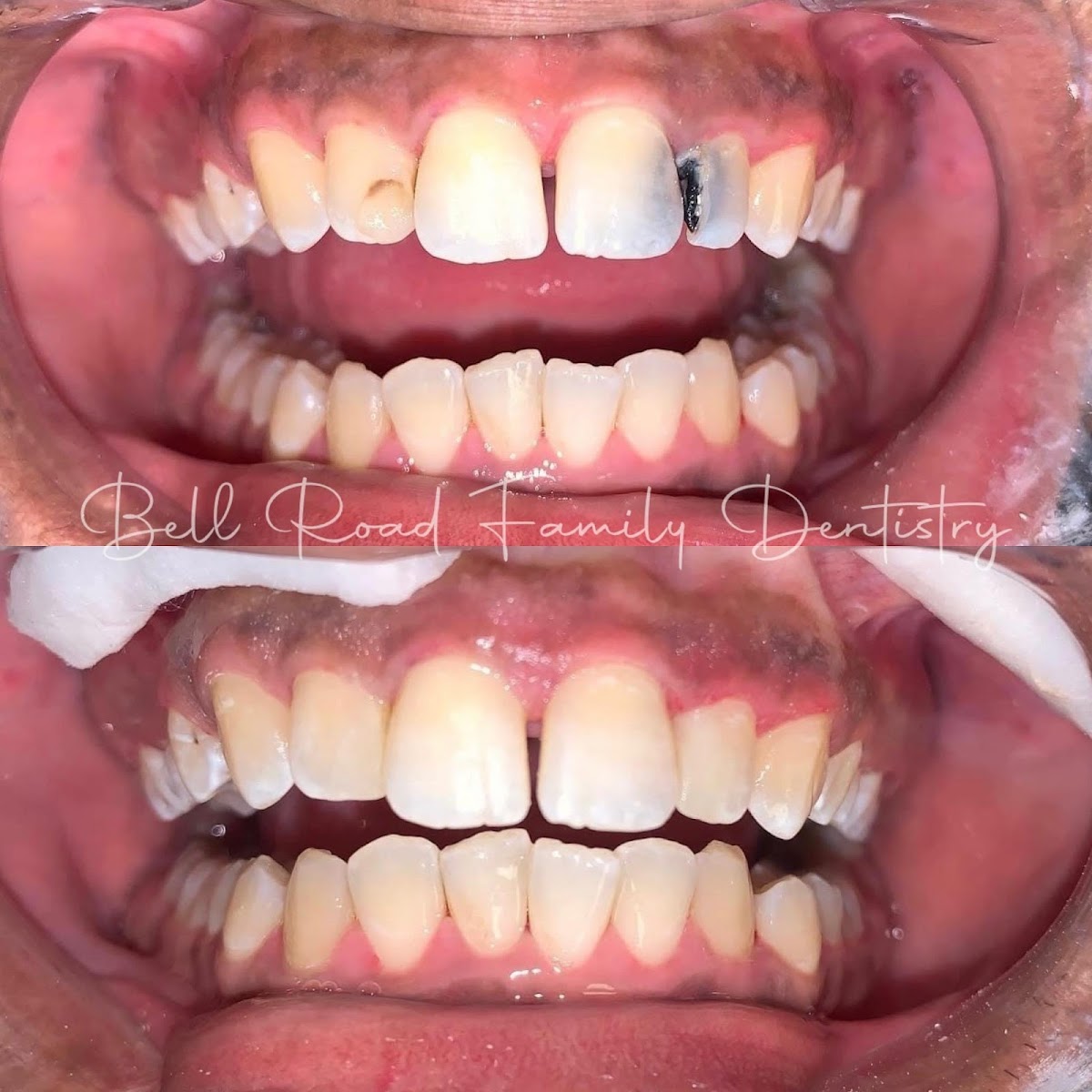 Bell Road Family Dentistry - Dentist Montgomery photo 4