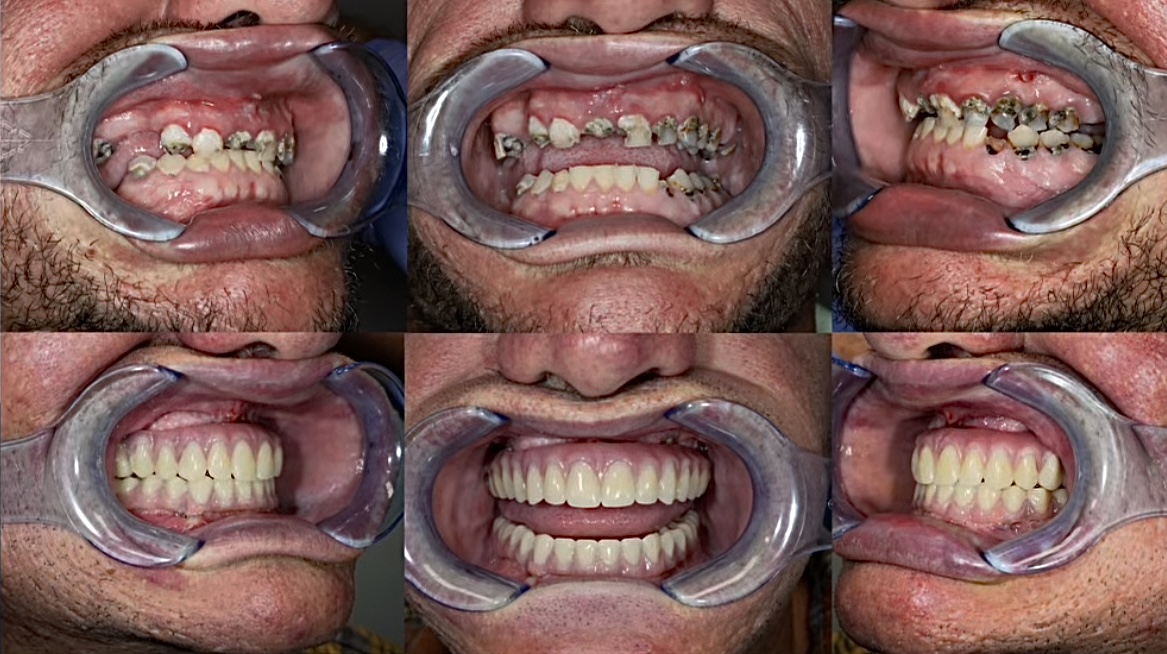 Bell Road Family Dentistry - Dentist Montgomery photo 6