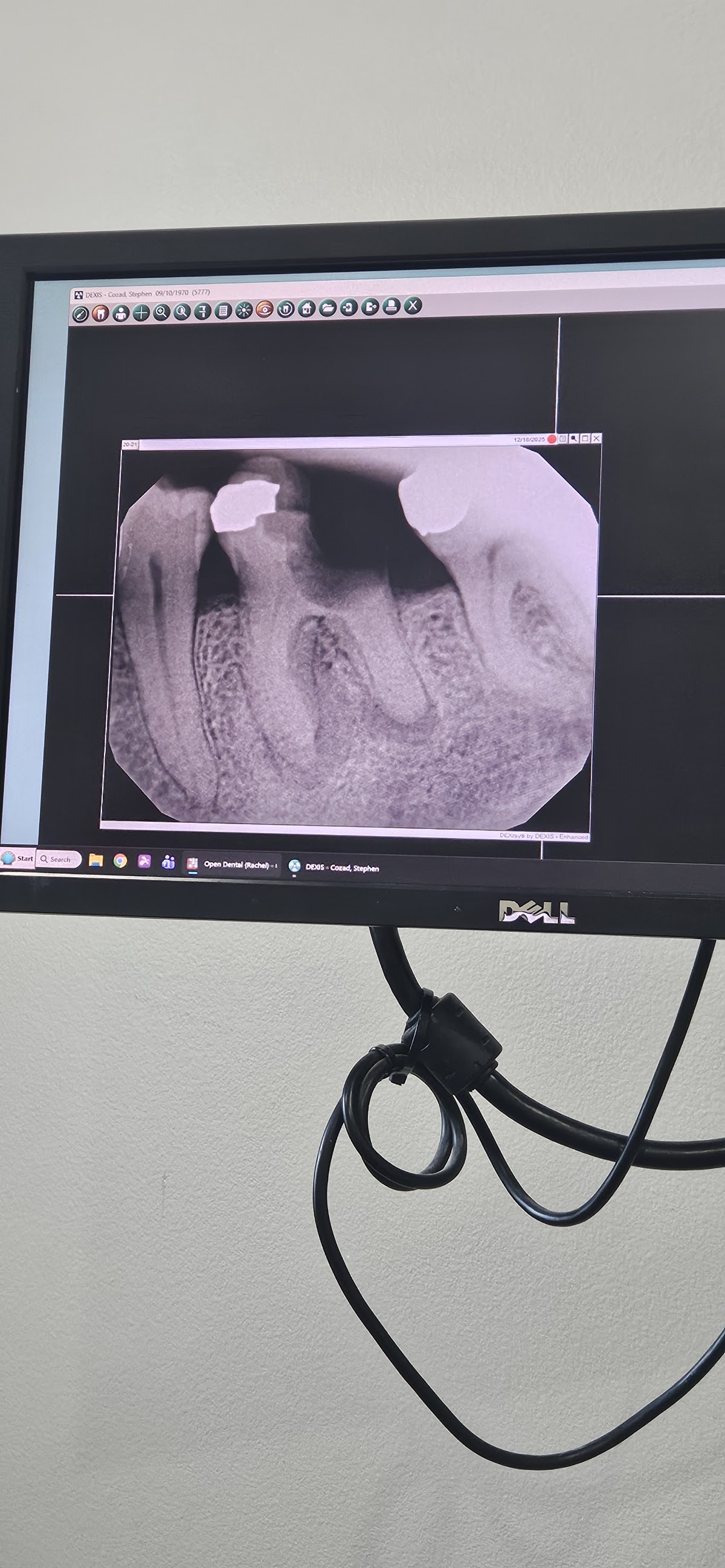 Ponchatoula Family Dentistry - Douglas M. George, DDS photo 3