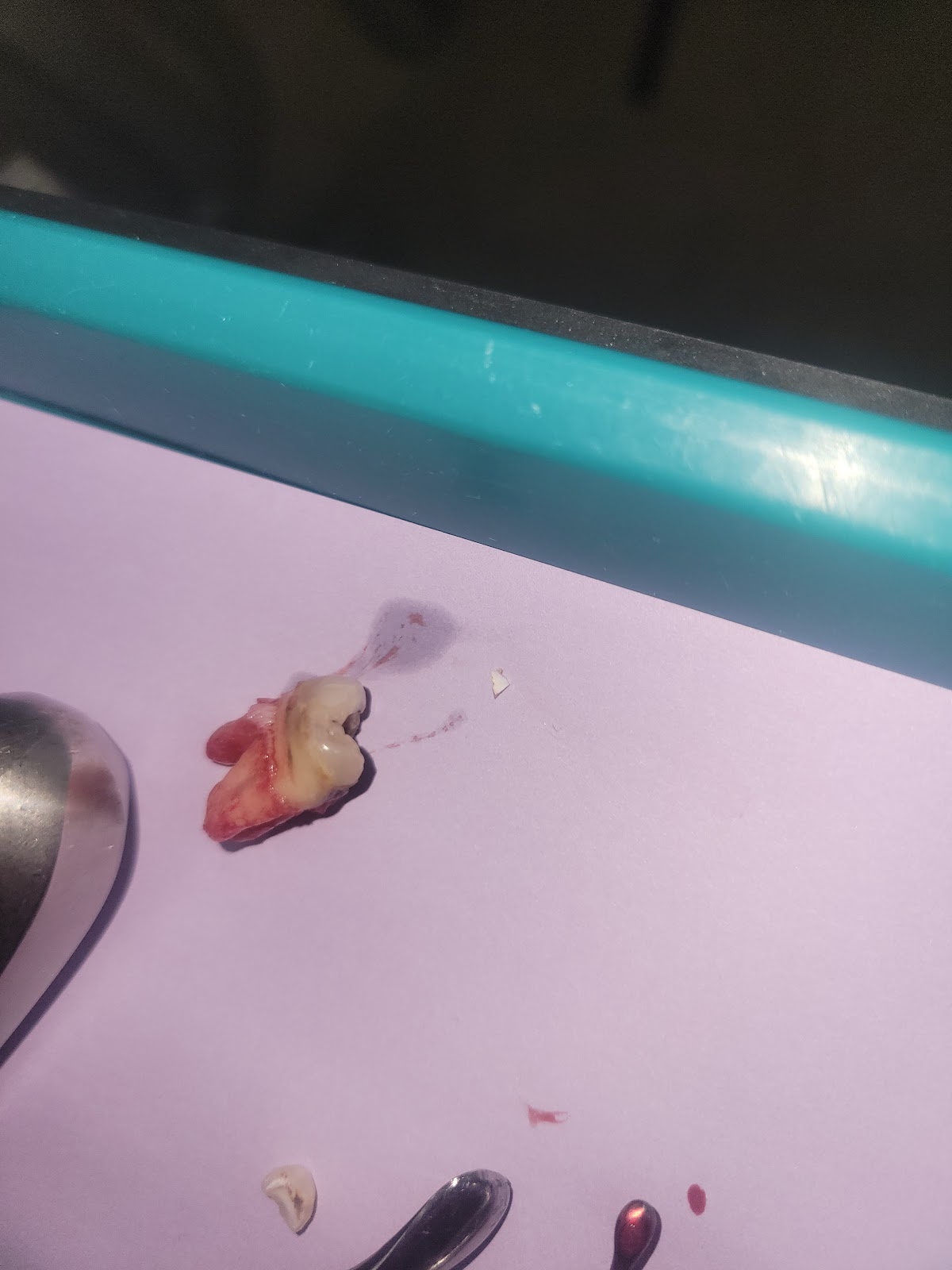 Aspen Dental - Chattanooga photo 4