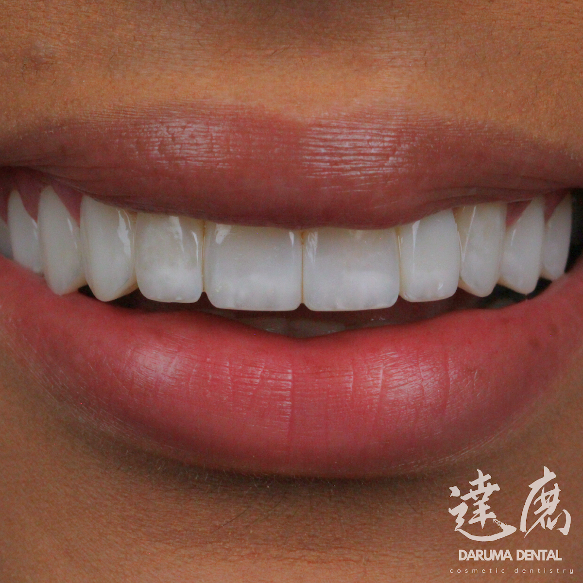 Daruma Dental photo 4