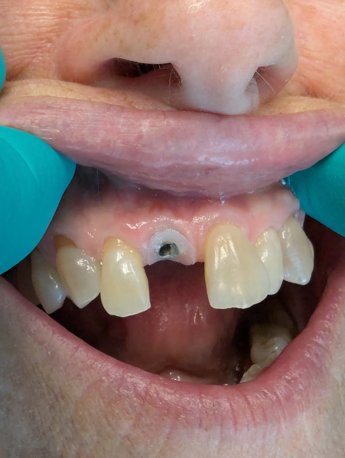 Tidewater Laser Perio and Implants photo 2