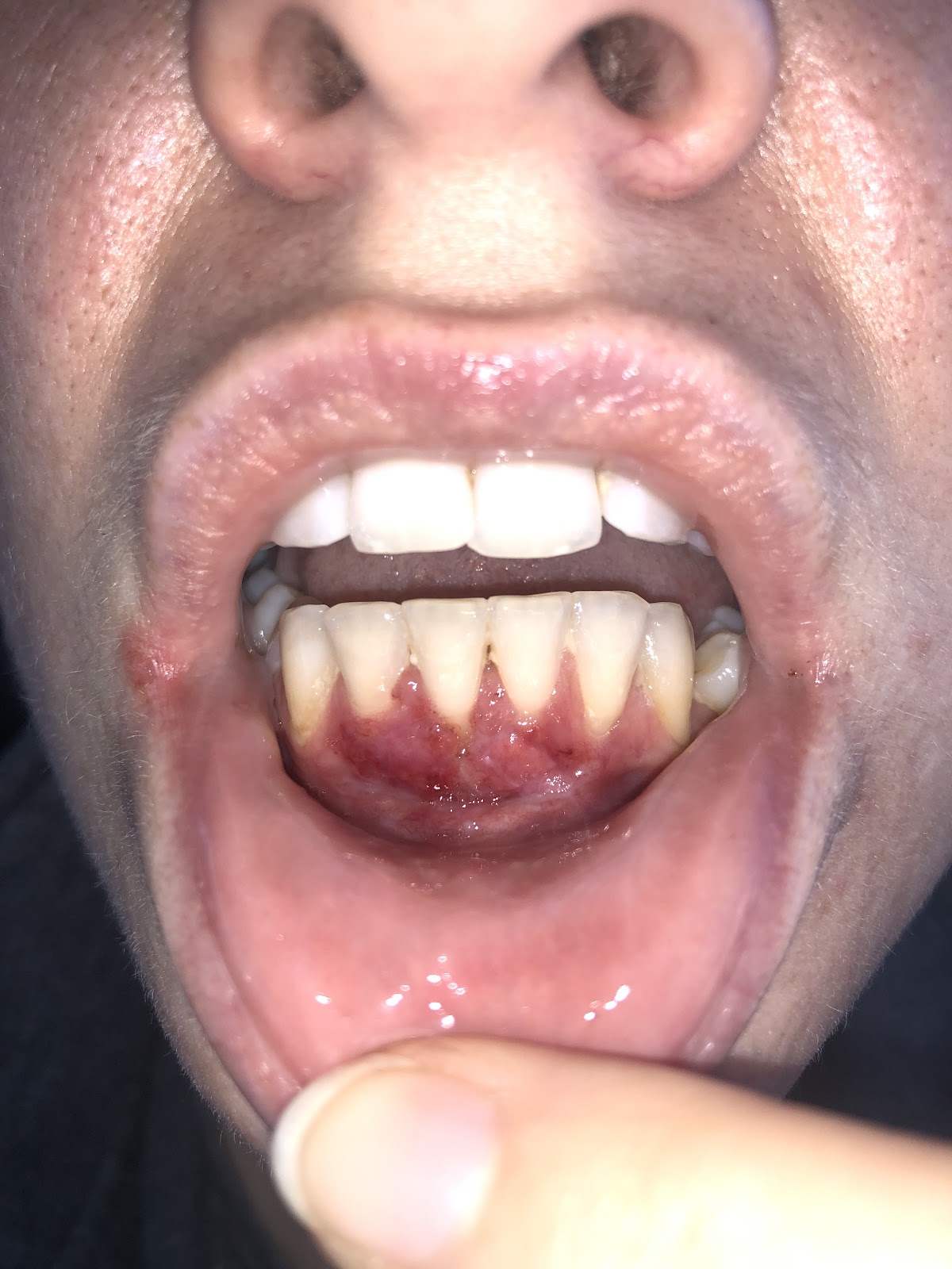 Tidewater Laser Perio and Implants photo 4