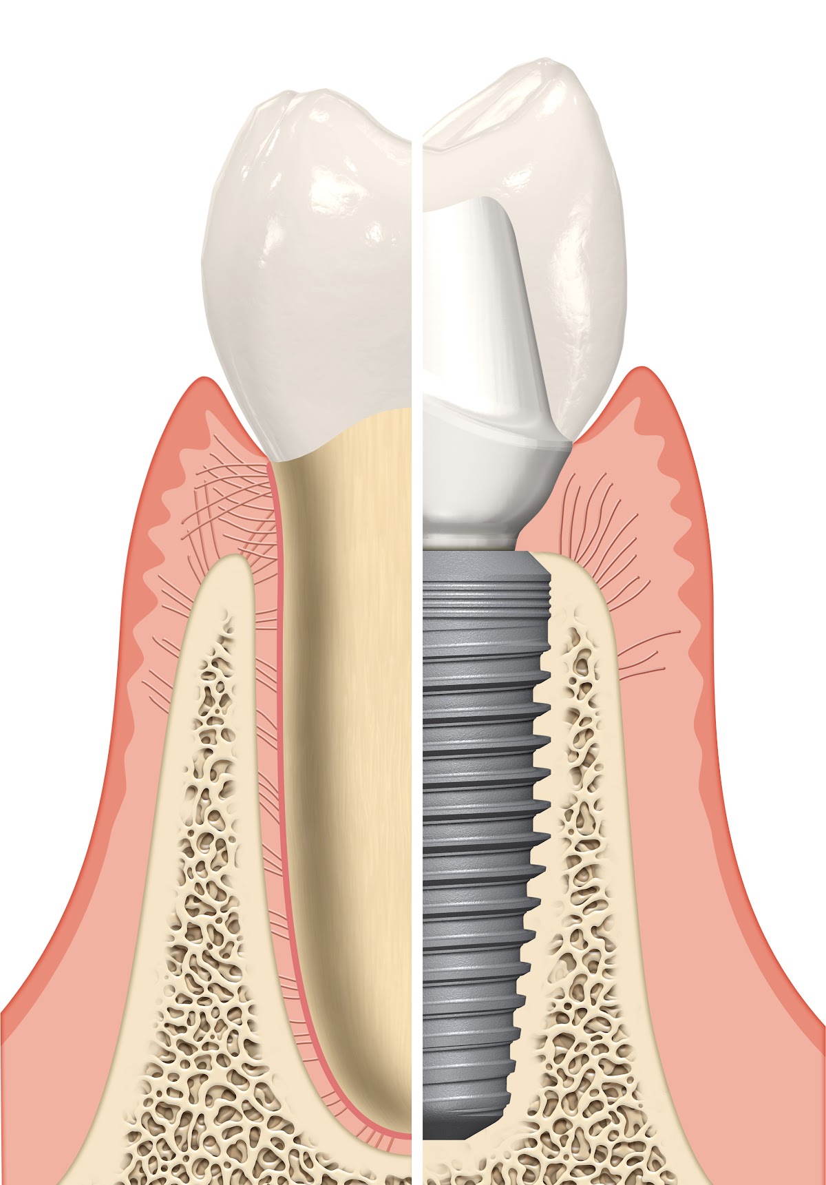 Sani Periodontics and Implant Dentistry - Www.thetravelingperiodontist.com photo 2