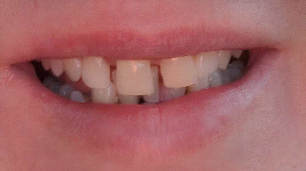 Clearchoice Dental Implant Center - Pittsburgh photo 2