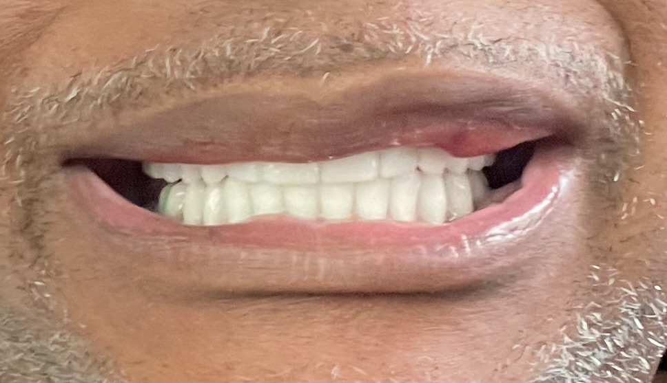 Clearchoice Dental Implant Center - Pittsburgh photo 3