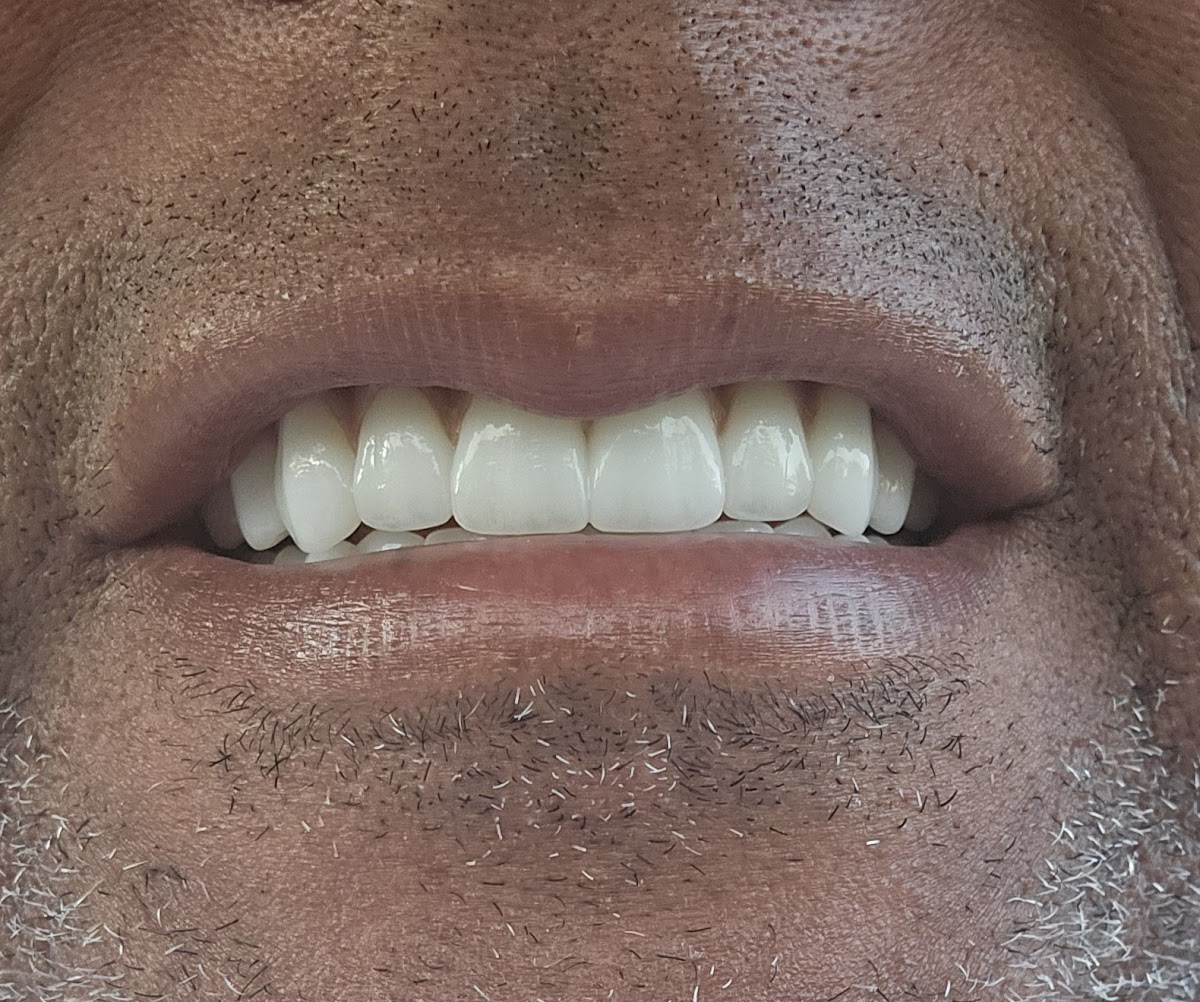 Clearchoice Dental Implant Center - Pittsburgh photo 4