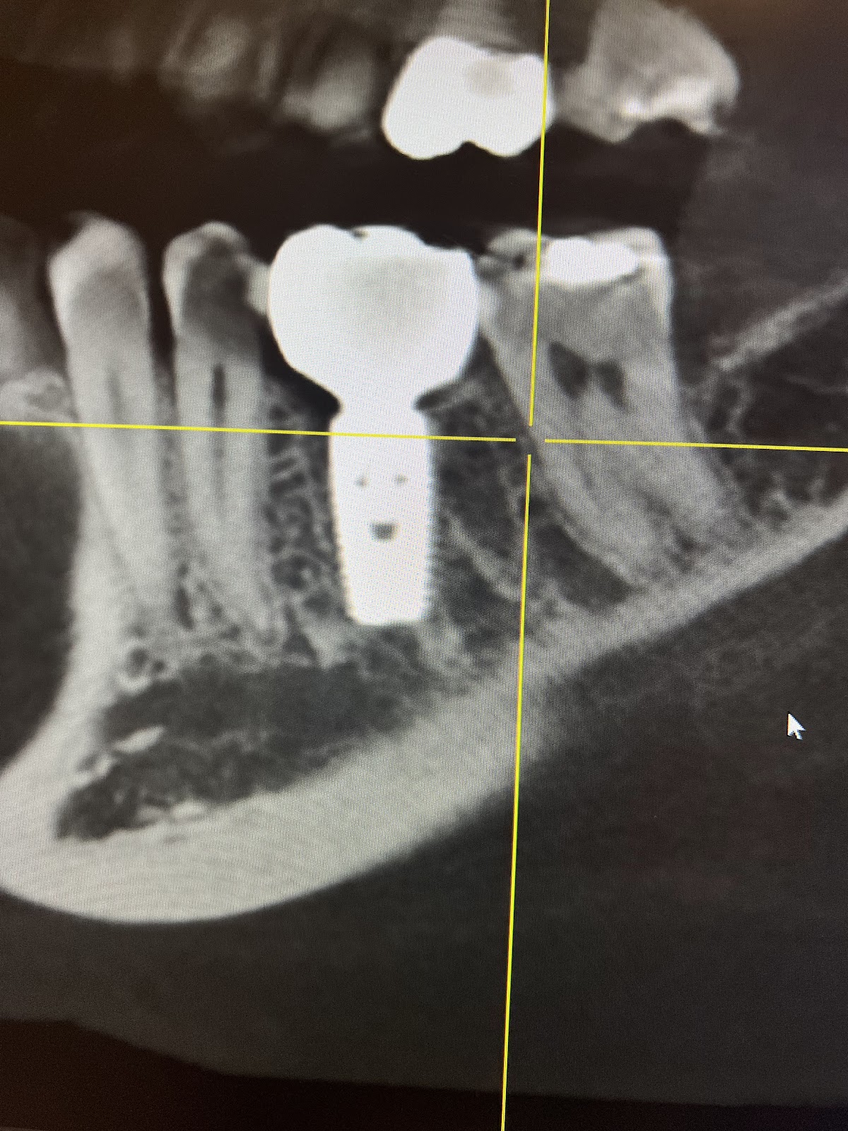 Dr. Eslami & Team Perio, Ahmad Eslami DDS photo 3