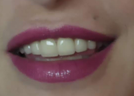Easy Dental Implant Center photo 4