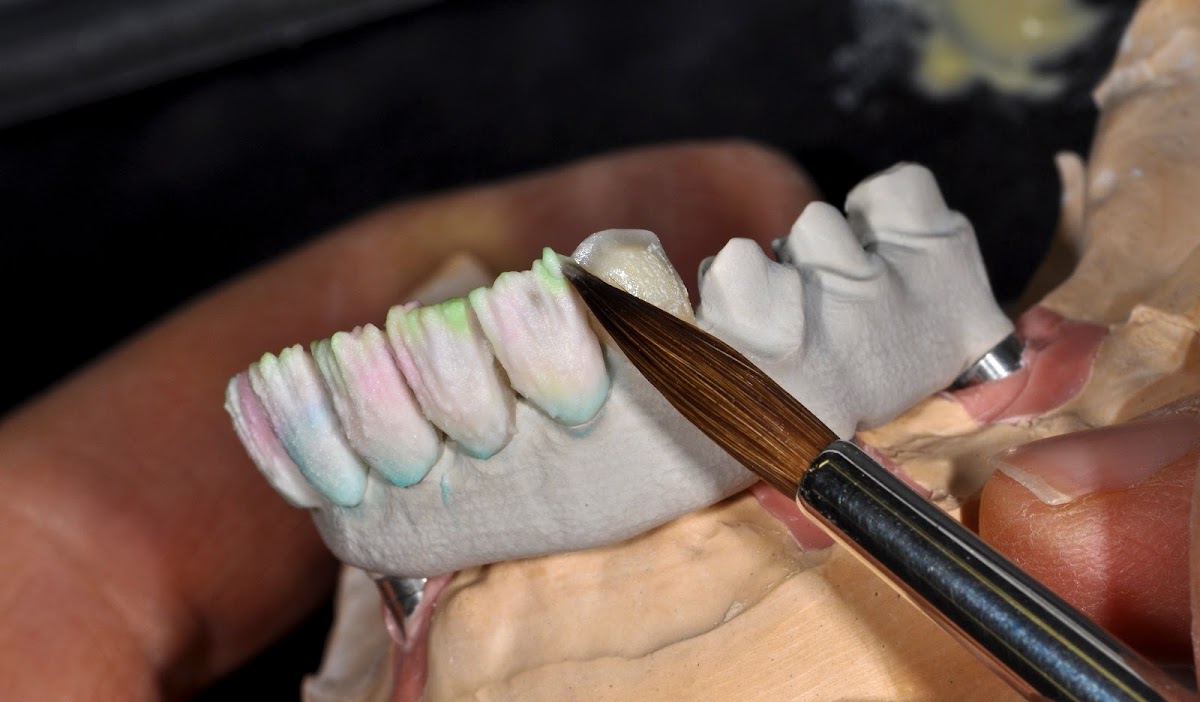 Renstrom Dental Studio photo 1