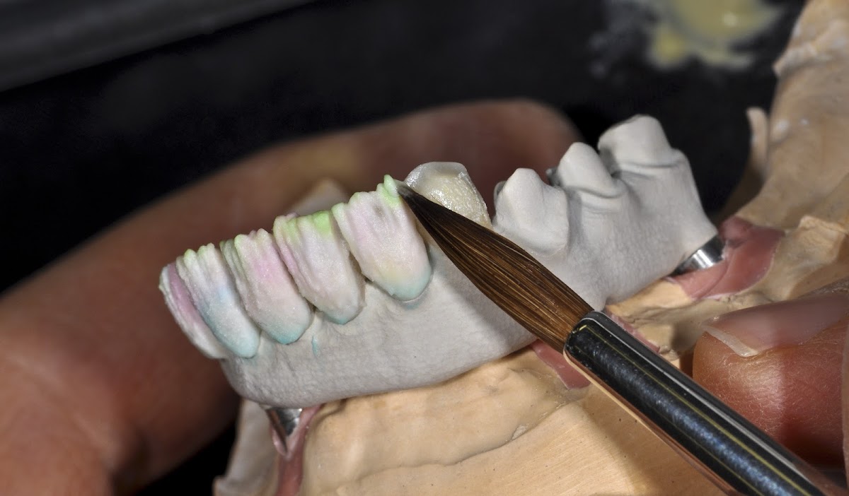 Renstrom Dental Studio photo 1