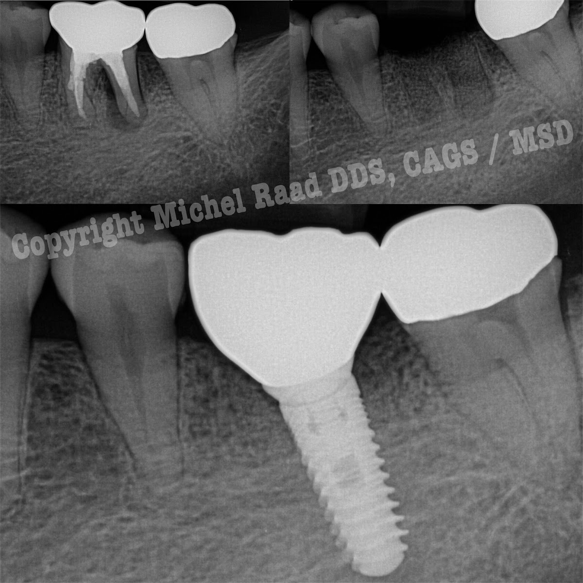 Luxor Dental: Prosthodontics, Dental Implants, And Wisdom Teeth Surgery photo 2