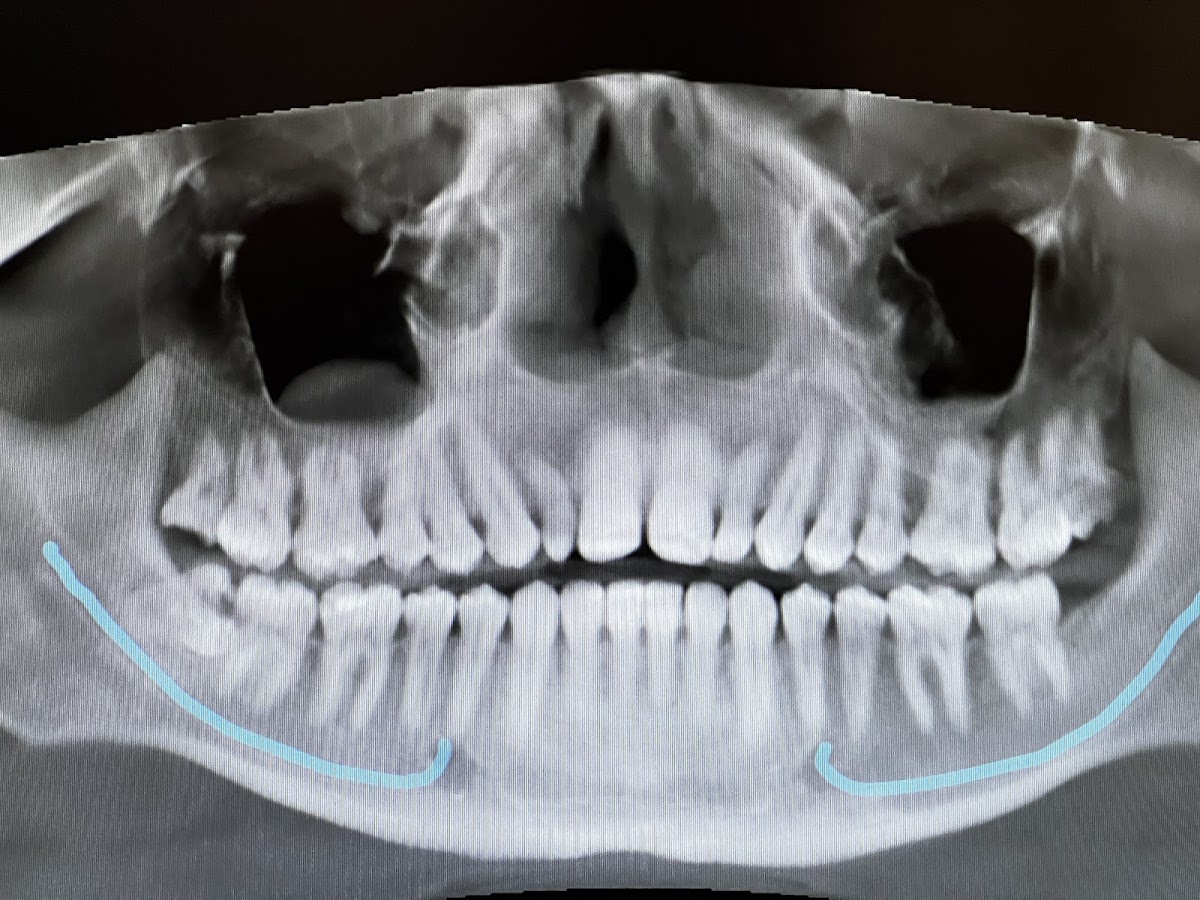 Reno Tahoe Oral Surgery & Dental Implant Center photo 4