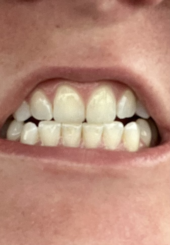 Aspen Dental - Warner Robins photo 3