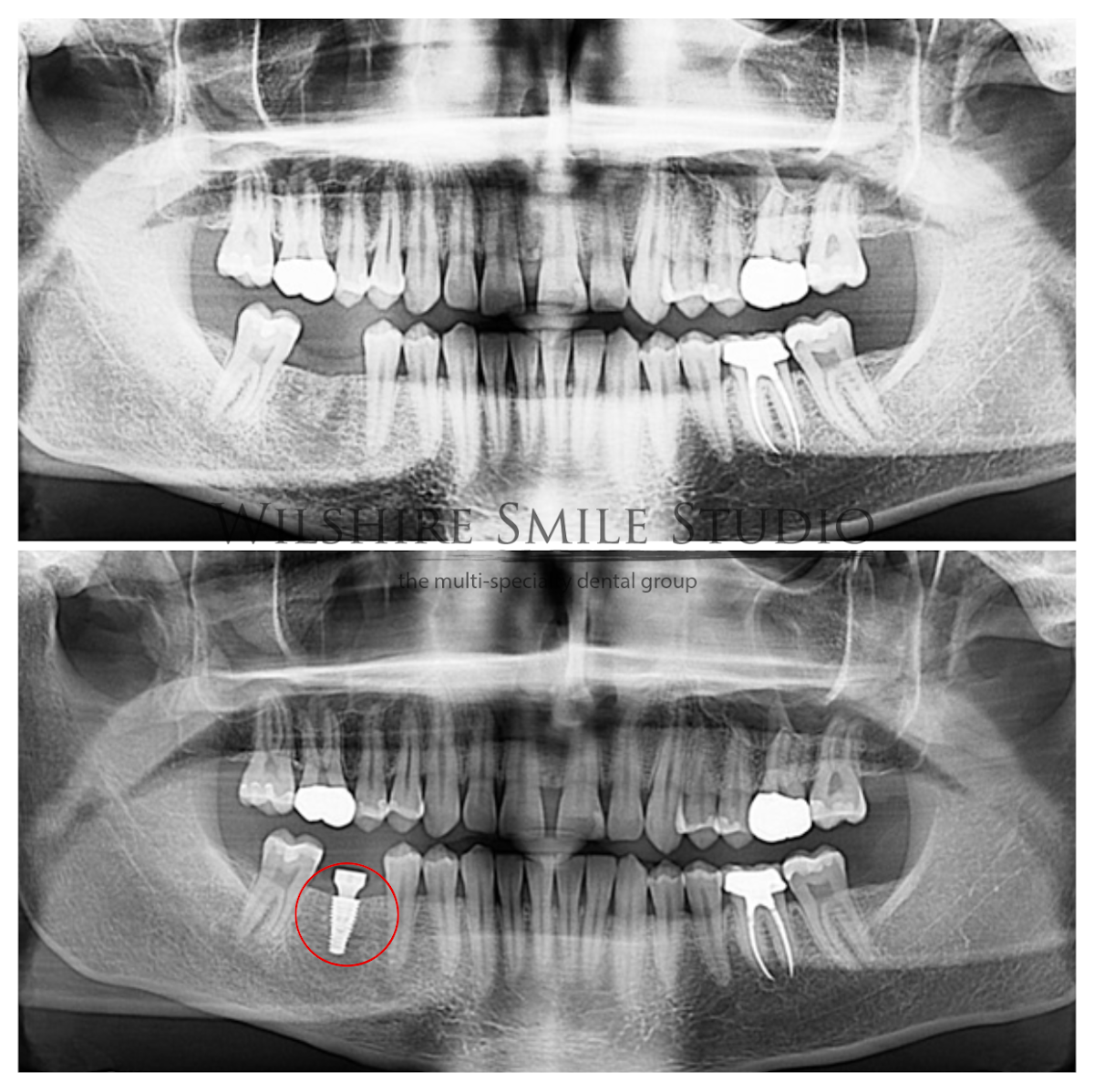 Los Angeles Oral Surgeon - Dr. Nariman Saadat - Oral Surgery Doctor photo 3