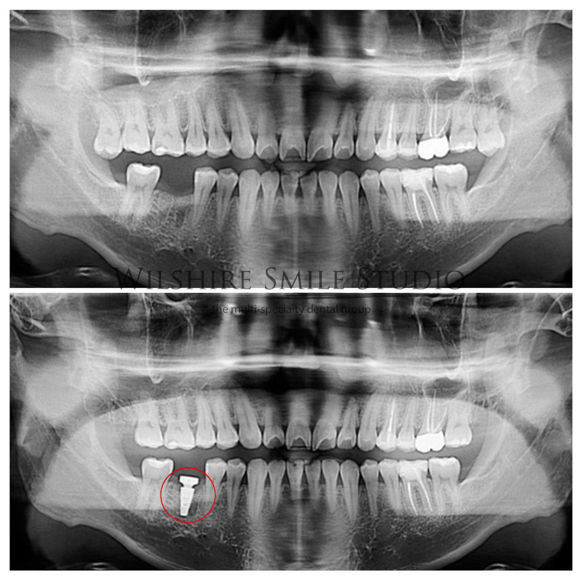 Los Angeles Oral Surgeon - Dr. Nariman Saadat - Oral Surgery Doctor photo 4